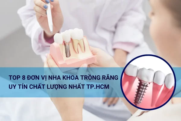 Top 8 đơn vị nha khoa trồng răng uy tin chất lượng tại TP.HCM